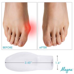 Toe Separators for Overlapping Toes Women Bunion Corrector Toe Spacers 2 Pcs. Bunion Relief Big Toe Gel Cushion Pads Big Toe Spreader Orthopedic Bunio - Image 4