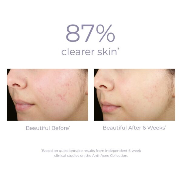 DERMA-E, Acne Rebalancing Cream Prevents Blemishes oz, 2 Ounce - Image 5