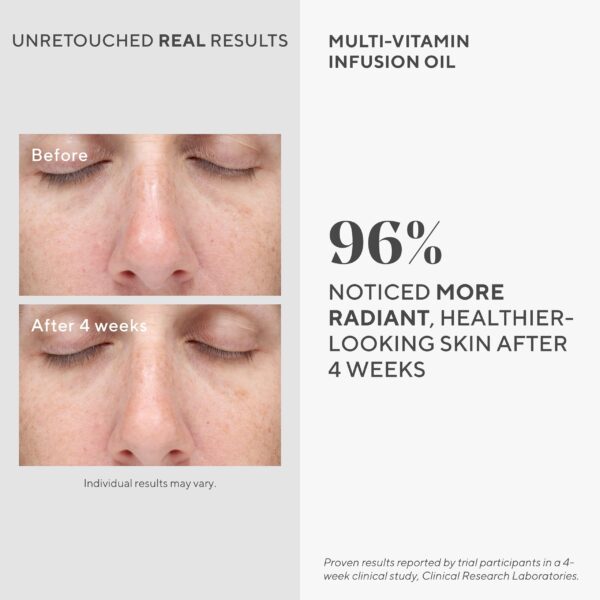 Murad Multi-Vitamin Infusion Facial Oil - Hydration Absorbs Quickly and Moisturizes with Vitamins A-F - Anti-Aging Skin Treatment Backed by Science - Image 3