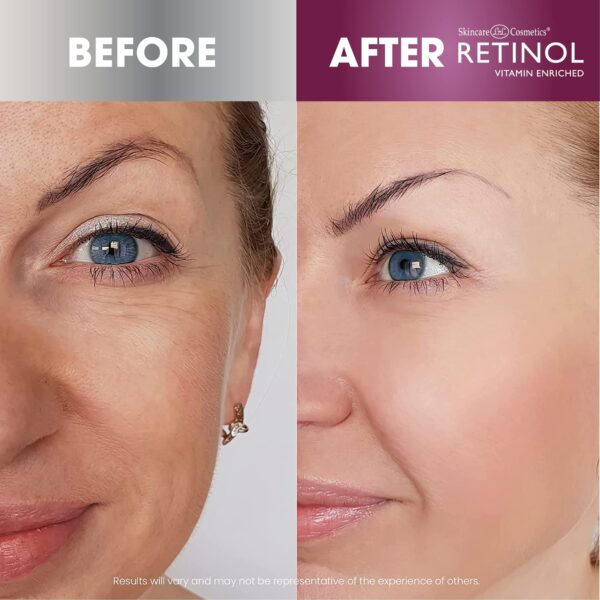 Retinol Day Cream Broad Spectrum SPF 20 ? Protects Against Harmful Effects of UVA & UVB Rays ? Luxurious Cream Moisturizes & Reduces Look of Fine Lines ? Provides Protection From Daily Sun Exposure - Image 5