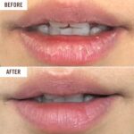 Hanalei Cruelty-Free Treatment for Chapped Lips, Extreme Dry Lip Moisturizer, Overnight Lip Balm for Cracked Lips, Made with Kukui Oil, Shea Butter, Grapeseed Oil, Clear Formula, Full Size (15 g) - Image 5