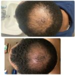 Kreyol Essence - 3.4 Oz Original Haitian Black Castor Oil - Hair growth, Thicker Brows and Longer Eyelashes, Natural Ingredients - Image 6