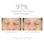 DERMA-E Anti-Wrinkle Renewal Skin Cream ? Vitamin A Wrinkle Treatment Cream ? Vegan Anti-Aging Moisturizer to Smooth & Renew Aging Skin, 4 oz - Image 5